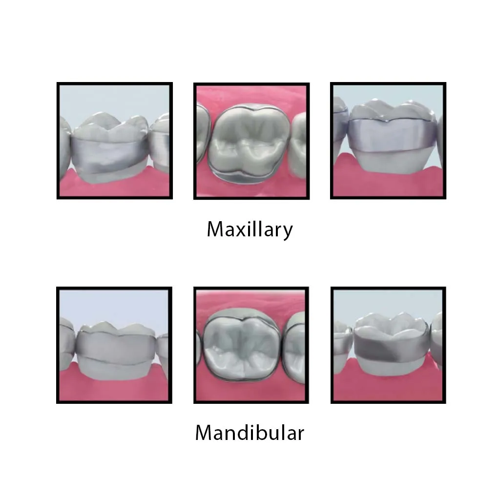 3M™ Victory Series™Micro-etched Narrow 1st Molar Band Introduction Kit, Lower, 150 Pcs/Pack